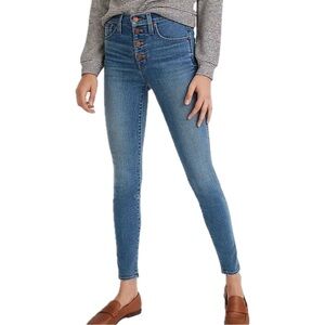 Madewell Button Fly 10” High Rise Skinny